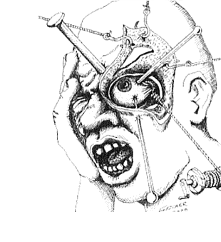 What is Cluster Headache?