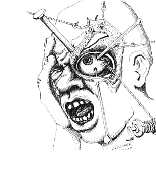 What is Cluster Headache? What is Cluster Headache?